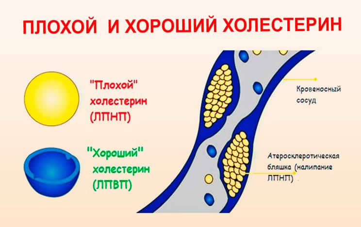 cholesterol 2a